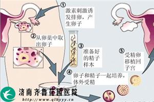 如何将供卵自怀医院移植到子宫内