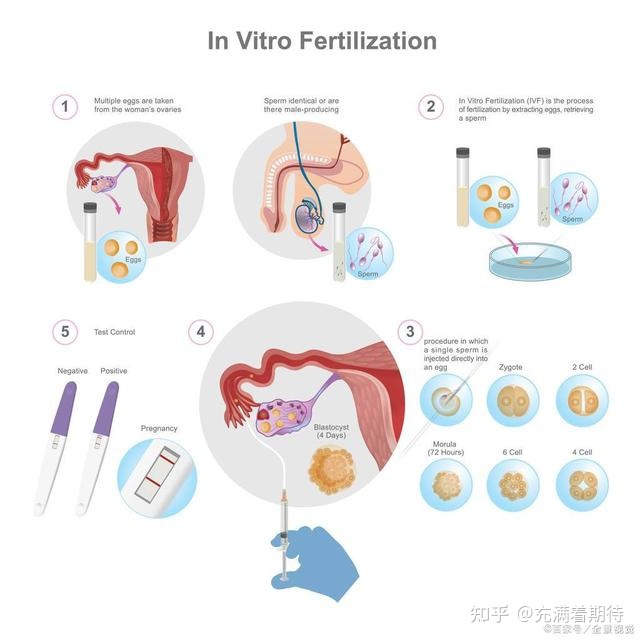 在海外生孩子：只是看起来不错