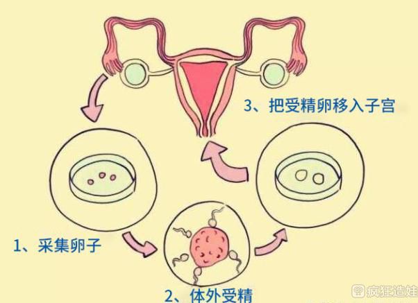 哪里有代怀生子哪一代技术更好三代试管代怀生男孩一二三代技术哪种最好