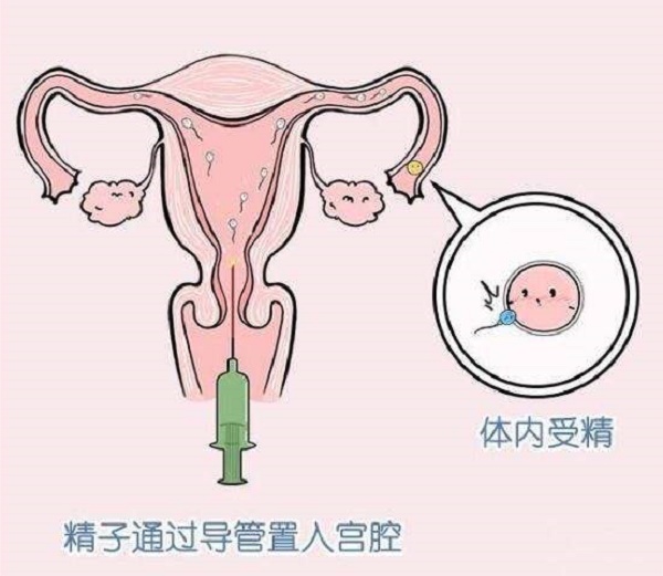 合肥军区总医院试管代怀费用表明细成功率