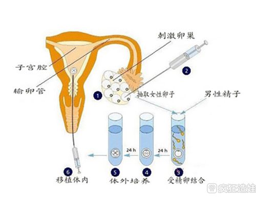 合肥市中心医院代生孩子价格多少成功率高吗