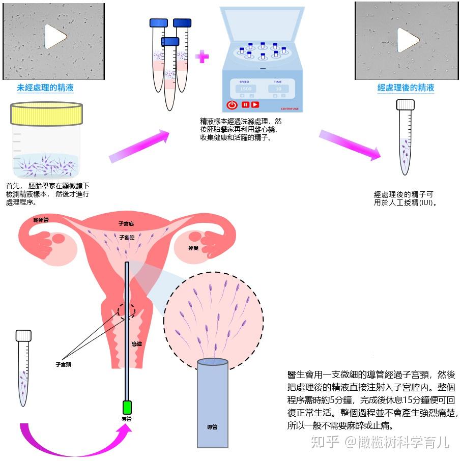 男性怎么提高Y精子活力与数量