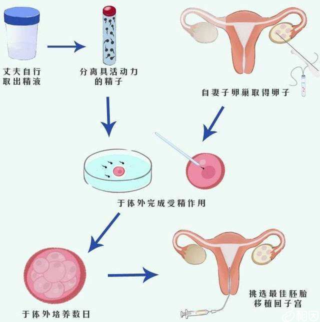 合肥附属医院有没有精子库