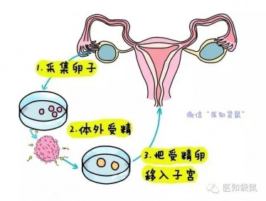 为什么有试管代怀公司要做哪些交叉_试管代怀可选男女婴儿需要做哪些准备