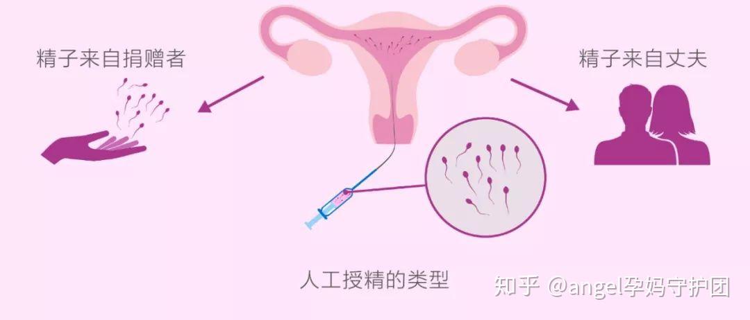 做试管代怀前的检查腹水多怎么办（还能做吗？）