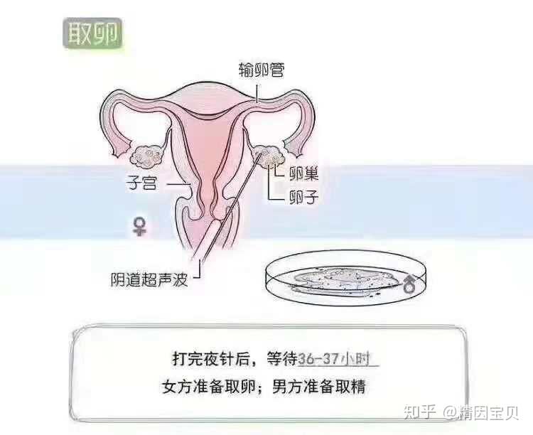 合肥总医院的医院做代怀选男孩成功率高不高