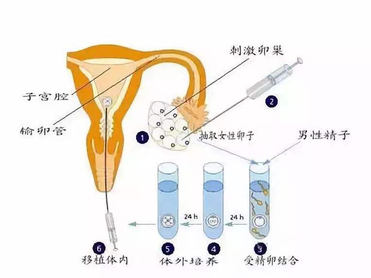 2024安徽合肥181代怀子正规代生婴儿费用是多少（费用明细一览!）